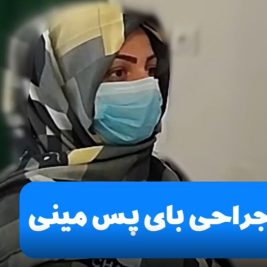 نظر بیمار جراحی بای پس مینی