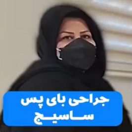 نظر بیماران در مورد جراحی بایپس ساسیج