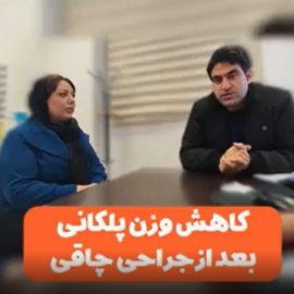 تجربه بیماران از کاهش وزن بعد جراحی لاغری